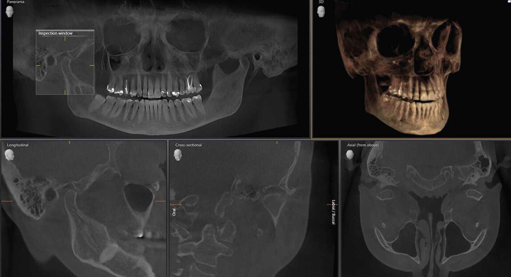 Axeos - Sistema de radiología 2D/3D - Image 7