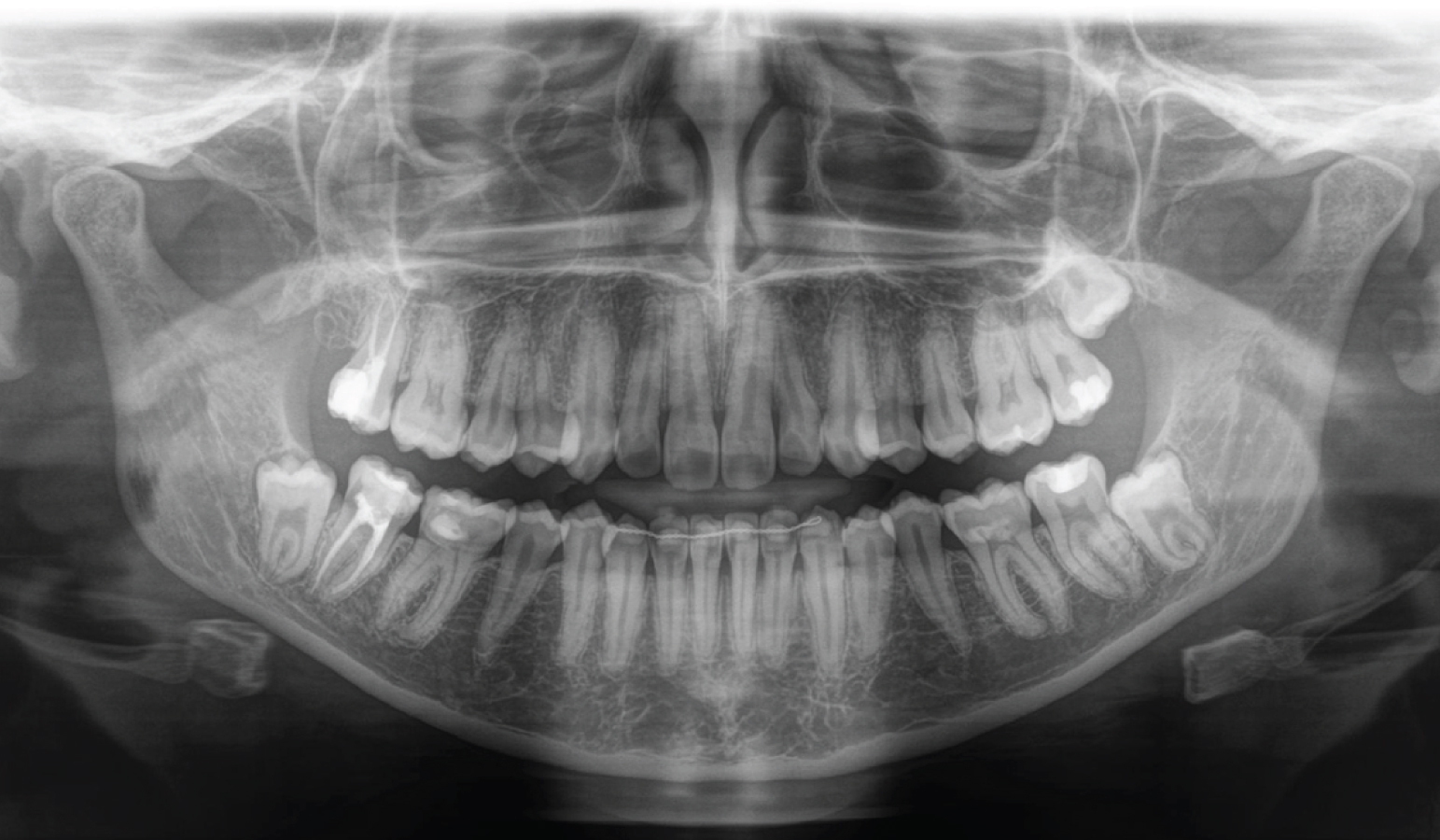 Axeos - Sistema de radiología 2D/3D - Image 5
