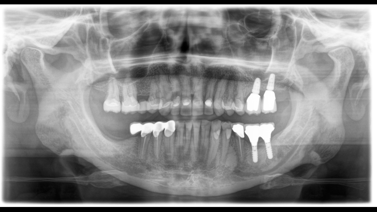 ORTHOPHOS S 2D - Image 6