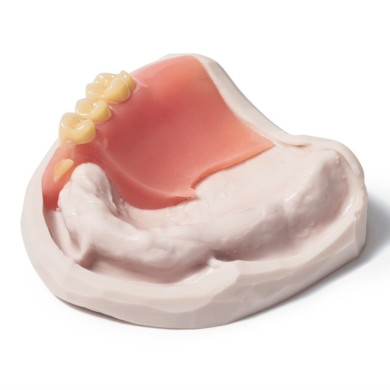 Zetalabor + Indurent gel - Image 3