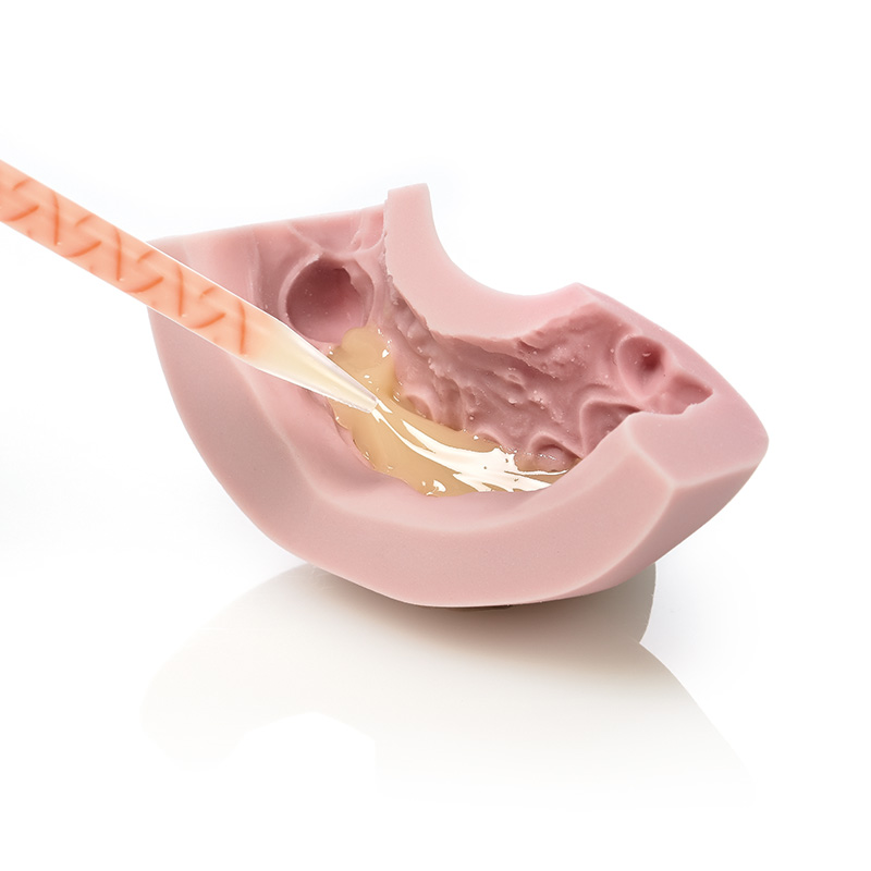 Zetalabor + Indurent gel - Image 4