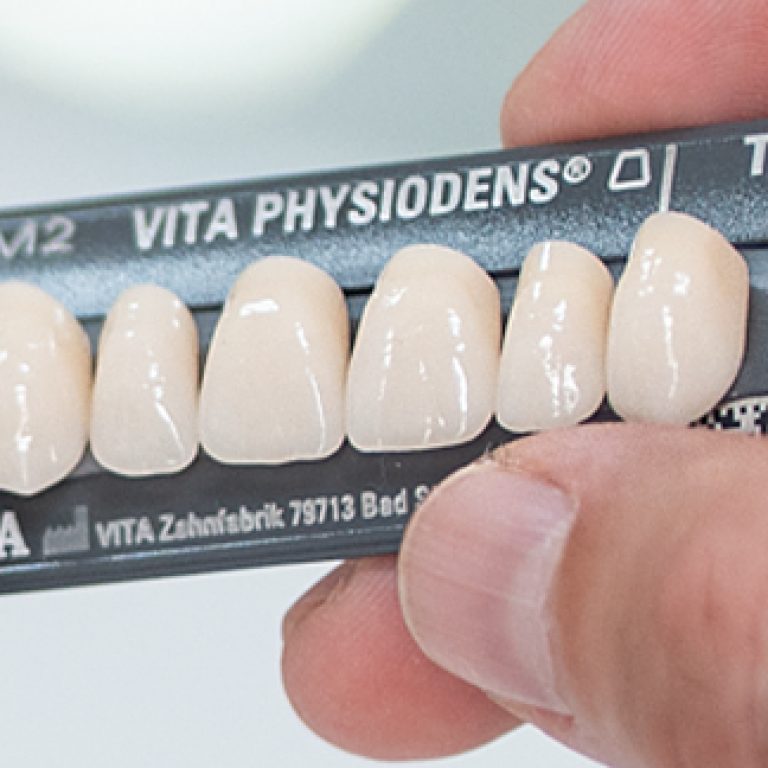 VITA-PHYSIODENS_Anterior_640_324_screen_web